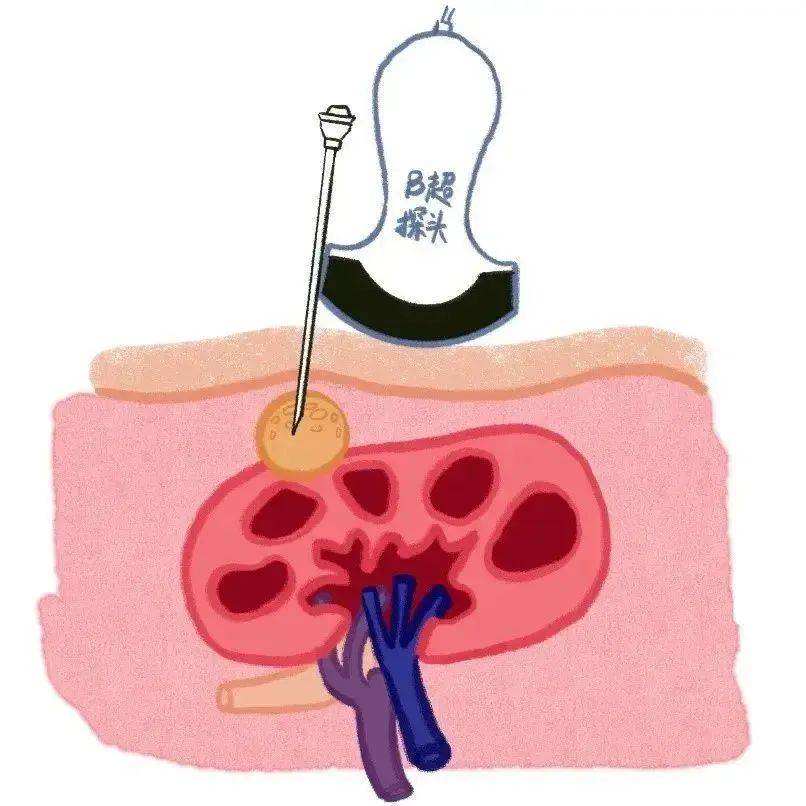 🌸【管家婆一肖一码100中】🌸-怀孕饮食红灯区！保护宝宝健康，这些食物要避开  第2张