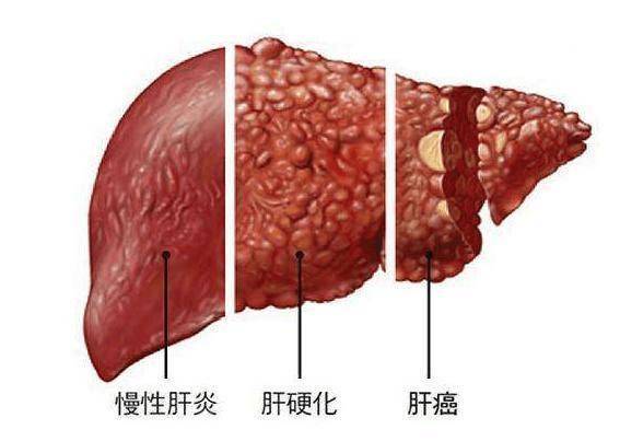 🌸【王中王一肖中特4933333】🌸-款家常面条做法，美味又健康  第2张