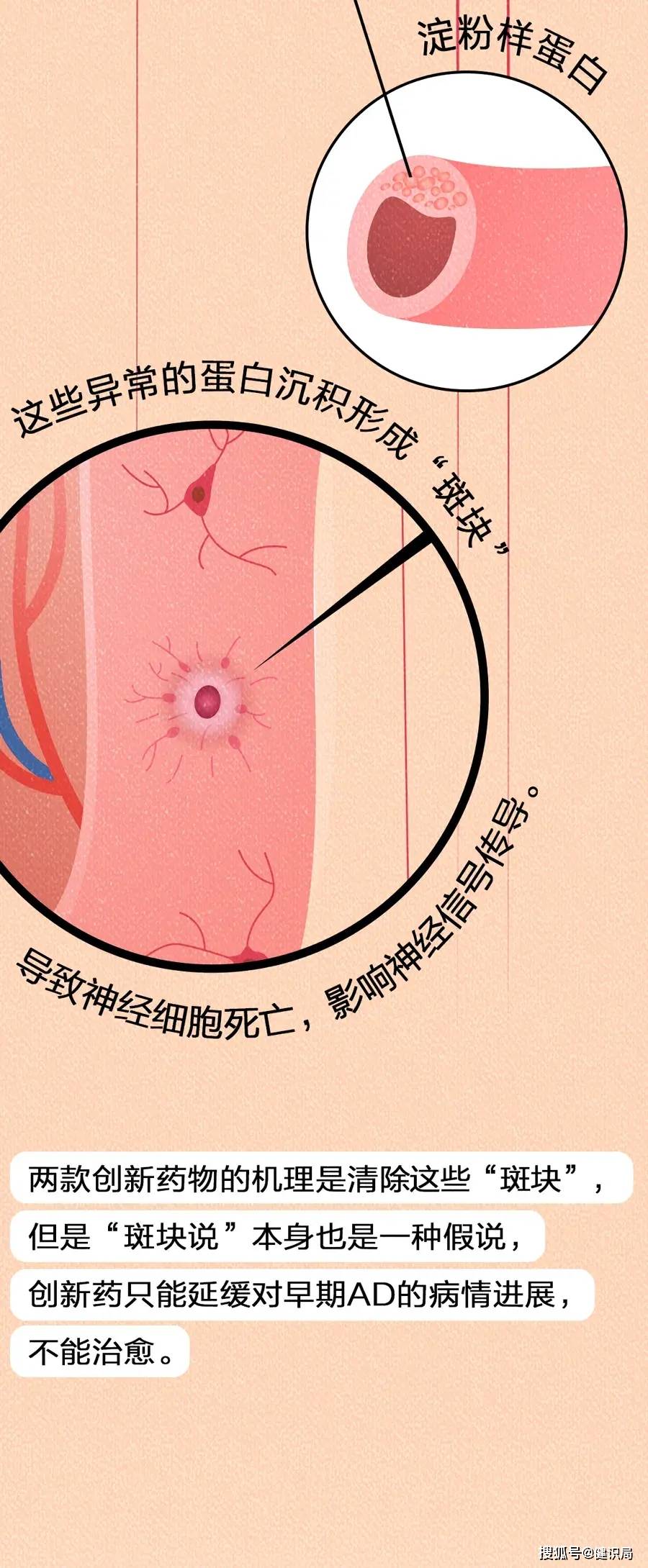 🌸【2023管家婆资料正版大全澳门】🌸-【健康河南】呼吸道过敏那些事儿