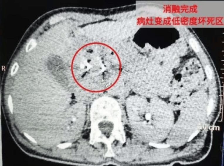 🌸【管家婆精准一肖一码100%】🌸-国际足联主席因凡蒂诺：将开发新的《FIFA》足球游戏  第2张